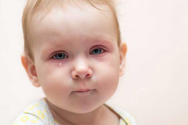 علت قی کردن چشم نوزاد