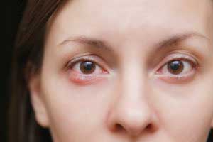 علت عفونت چشم